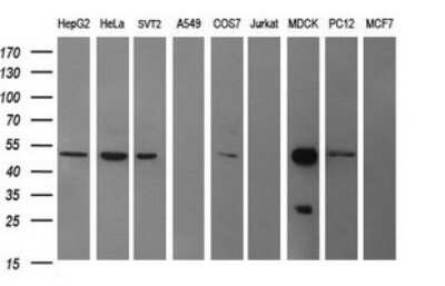 Western Blot: beta II Tubulin B Antibody (OTI6D11) [NBP2-46250]