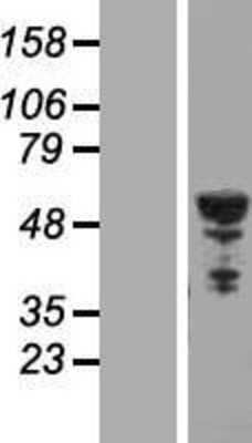 Western Blot: beta II Tubulin B Overexpression Lysate [NBL1-17438]