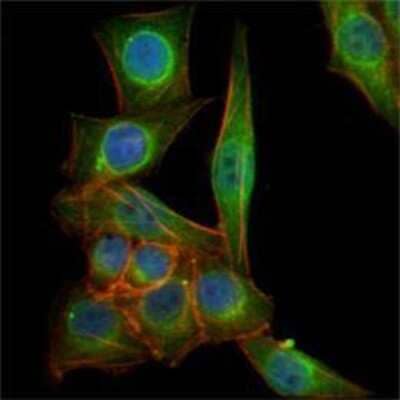 Immunocytochemistry/ Immunofluorescence: beta-III Tubulin Antibody (2E9) [NBP1-42568]