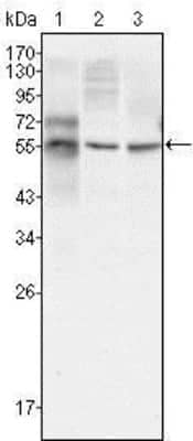 Western Blot: beta-III Tubulin Antibody (2E9) [NBP1-42568]