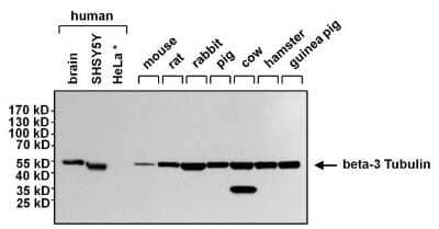 Western Blot: beta-III Tubulin Antibody (2G10) [NBP2-37816]