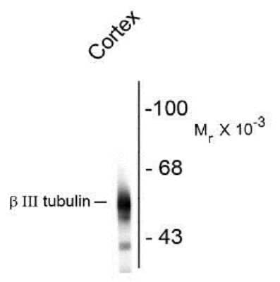 Western Blot: beta-III Tubulin Antibody (AA10) [NBP1-30048]