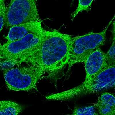 Immunocytochemistry/ Immunofluorescence: beta-III Tubulin Antibody (CL5813) [NBP2-61430]