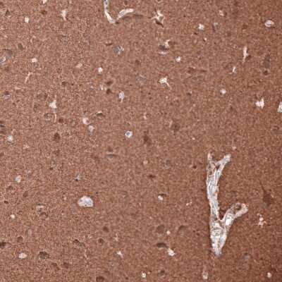 Immunohistochemistry-Paraffin: beta-III Tubulin Antibody (CL5813) [NBP2-61430]