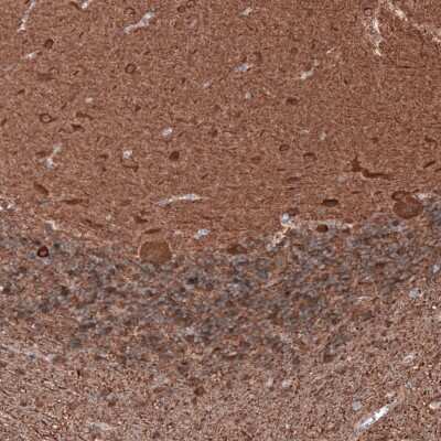 Immunohistochemistry-Paraffin: beta-III Tubulin Antibody (CL5813) [NBP2-61430]