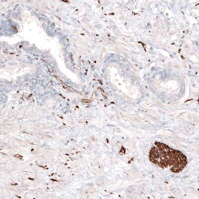 Immunohistochemistry-Paraffin: beta-III Tubulin Antibody (CL5813) [NBP2-61430]