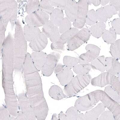 Immunohistochemistry-Paraffin: beta-III Tubulin Antibody (CL5813) [NBP2-61430]