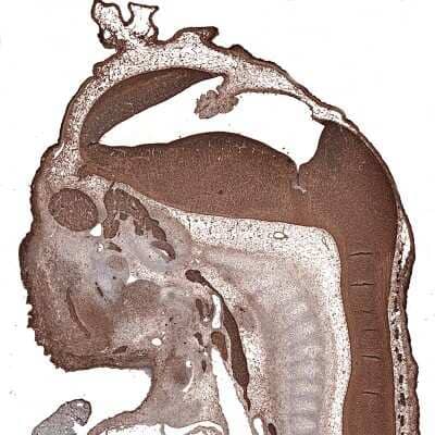 Immunohistochemistry-Paraffin: beta-III Tubulin Antibody (CL5813) [NBP2-61430]