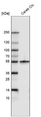 Western Blot: beta-III Tubulin Antibody (CL5813) [NBP2-61430]