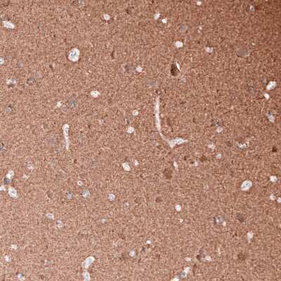 Immunohistochemistry-Paraffin: beta-III Tubulin Antibody (CL5814) [NBP2-61431]