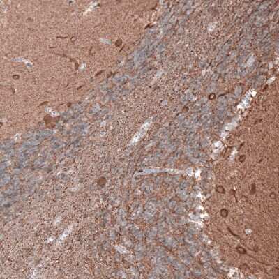Immunohistochemistry-Paraffin: beta-III Tubulin Antibody (CL5814) [NBP2-61431]