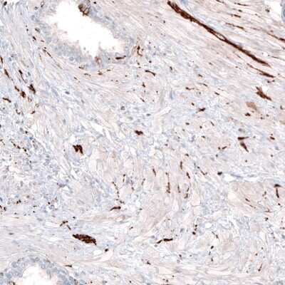 Immunohistochemistry-Paraffin: beta-III Tubulin Antibody (CL5814) [NBP2-61431]