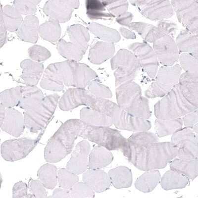 Immunohistochemistry-Paraffin: beta-III Tubulin Antibody (CL5814) [NBP2-61431]