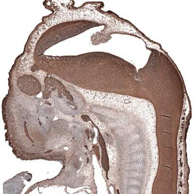 Immunohistochemistry-Paraffin: beta-III Tubulin Antibody (CL5814) [NBP2-61431]
