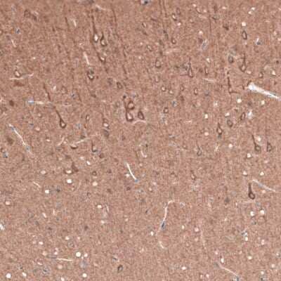 Immunohistochemistry-Paraffin: beta-III Tubulin Antibody (CL5814) [NBP2-61431]
