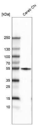 Western Blot: beta-III Tubulin Antibody (CL5814) [NBP2-61431]