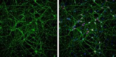 Immunocytochemistry/ Immunofluorescence: beta-III Tubulin Antibody (GT1338) [NBP3-13505]