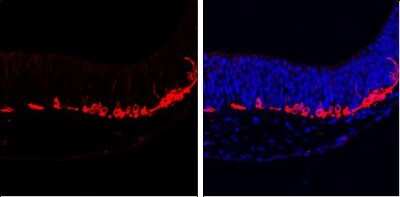 Immunohistochemistry-Paraffin: beta-III Tubulin Antibody (GT1338) [NBP3-13505]