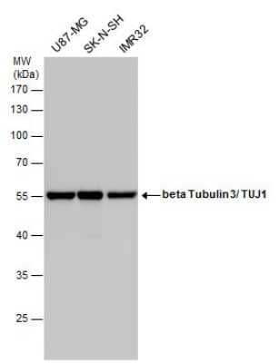 Western Blot: beta-III Tubulin Antibody (GT1338) [NBP3-13505]