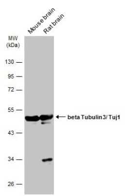 Western Blot: beta-III Tubulin Antibody (GT1338) [NBP3-13505]