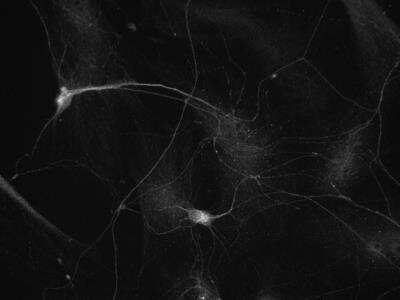 Immunocytochemistry/ Immunofluorescence: beta-III Tubulin Antibody [NB100-1612]