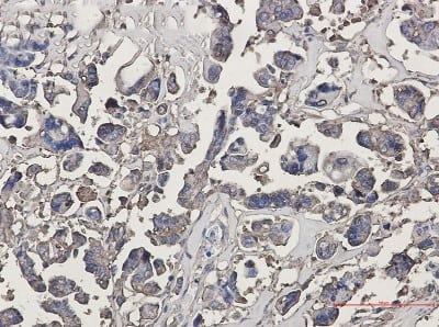 Immunohistochemistry-Paraffin: beta-III Tubulin Antibody (S02-4G7) [NBP3-19582]