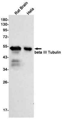 Western Blot: beta-III Tubulin Antibody (S02-4G7) [NBP3-19582]