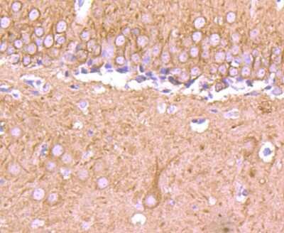 Immunohistochemistry-Paraffin: beta-III Tubulin Antibody (SP06-00) [NBP2-67374]
