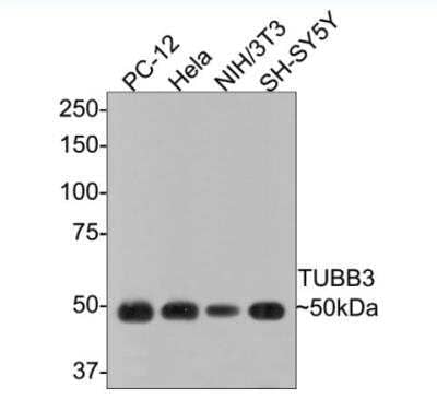 Western Blot: beta-III Tubulin Antibody (SP06-00) [NBP2-67374]