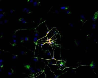 Immunocytochemistry/ Immunofluorescence: beta-III Tubulin Antibody (TU-20) - BSA Free [NB600-1018]