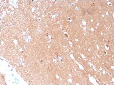 Immunohistochemistry-Paraffin: beta-III Tubulin Antibody (TUBB3/3731) [NBP3-07385]