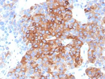 Immunohistochemistry-Paraffin: beta-III Tubulin Antibody (TUBB3/3732) - Azide and BSA Free [NBP3-08455]
