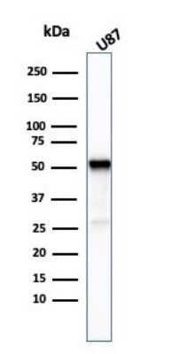 Western Blot: beta-III Tubulin Antibody (TUBB3/3732) [NBP3-07386]