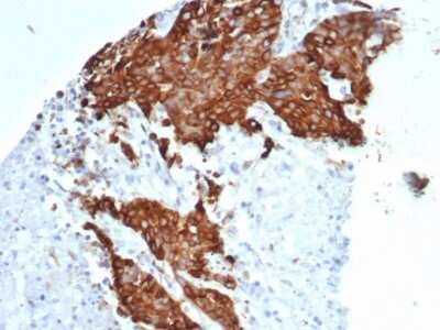 Immunohistochemistry-Paraffin: beta-III Tubulin Antibody (TUBB3/7089R) [NBP3-13836]