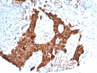 Immunohistochemistry-Paraffin: beta-III Tubulin Antibody (TUBB3/7090R) [NBP3-13837]