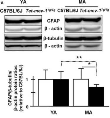 Western Blot: beta-III Tubulin Antibody [NB100-1612]