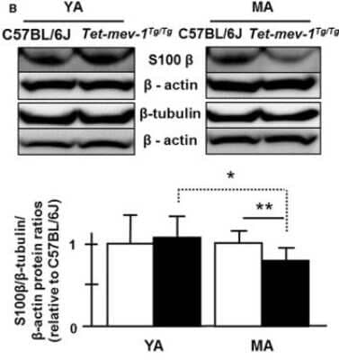 Western Blot: beta-III Tubulin Antibody [NB100-1612]