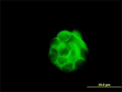 Immunocytochemistry/ Immunofluorescence: beta Sarcoglycan Antibody (1C10) [H00006443-M02]