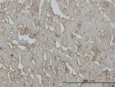 Immunohistochemistry-Paraffin: beta Sarcoglycan Antibody (1C10) [H00006443-M02]
