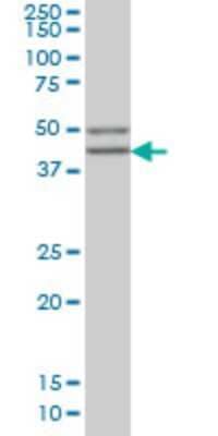 Western Blot: beta Sarcoglycan Antibody (1C10) [H00006443-M02]