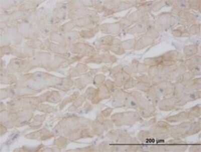 Immunohistochemistry-Paraffin: beta Sarcoglycan Antibody (1E3) [H00006443-M01]