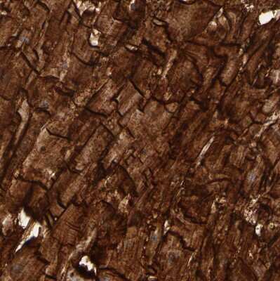Immunohistochemistry-Paraffin: beta Sarcoglycan Antibody [NBP1-90300]