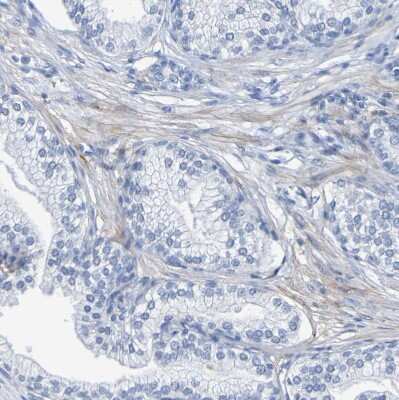 Immunohistochemistry-Paraffin: beta Sarcoglycan Antibody [NBP1-90300]