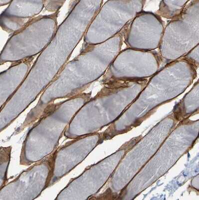 Immunohistochemistry-Paraffin: beta Sarcoglycan Antibody [NBP1-90300]