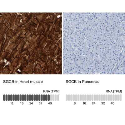 Immunohistochemistry-Paraffin: beta Sarcoglycan Antibody [NBP1-90300]