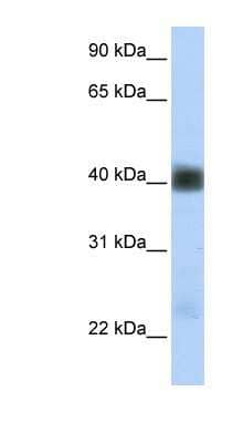 Western Blot: beta Sarcoglycan Antibody [NBP1-59751]