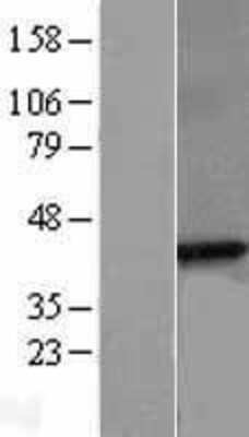 Western Blot: beta Sarcoglycan Overexpression Lysate [NBL1-15903]