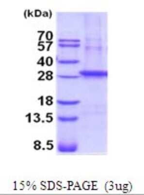 SDS-PAGE: Recombinant Human beta Sarcoglycan His Protein [NBP2-52098]