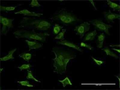 Immunocytochemistry/ Immunofluorescence: beta-Synuclein Antibody (3G6) [H00006620-M02]