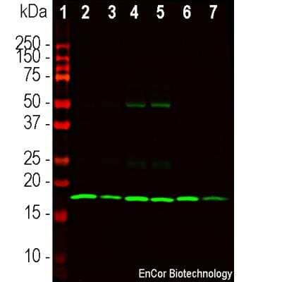 Western Blot: beta-Synuclein Antibody [NBP3-05529]